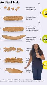 Image result for thin ribbon stools human poop