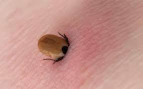 If you find a tick that has attached itself, engorged with blood or not, you can remove it safely if you follow these guidelines. Should You Use Liquid Soap To Remove Ticks Snopes Com