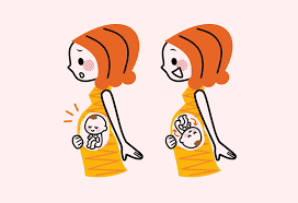 Image result for External Cephalic Version