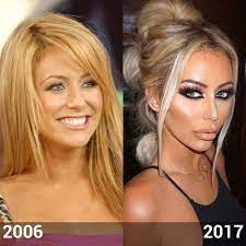 After she shared some photos on instagram recently, fans were surprised by her strange new appearance. Aubrey O Day Transformation Photos Of Her Then And Now