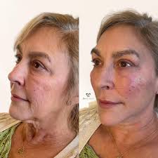 We added free BOTOX!!! GIVEAWAY!! •we're buying your hair extensions up to  20” (if you want longer you just have to pay the difference) •install  •entire extension repair kit line •2 brow