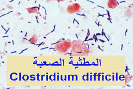 pin on أعراض و أمراض