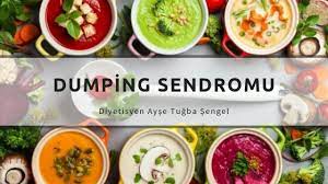Dumping sendromu, mide baypas ameliyatı geçiren kişilerde ortaya çıkan, alınan karbonhidrat içeriği zengin besinlerin ince bağırsağa hızlı geçişine bağlı olarak oluşan bir durumdur. Dumping Sendromu Nedir Tup Mide Ameliyati Sonrasi Beslenme