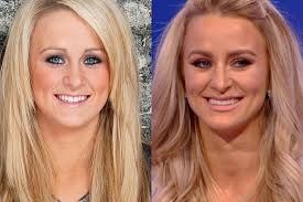 Before and After: why I think Leah Messer got a nose job :  rTeenMomOGandTeenMom2