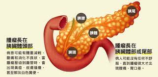 國民健康署免費成人健康檢查 國民健康署戒菸特別門診 一般外傷處理 流感疫苗及各種公自費疫苗注射 血液生化尿液糞便檢查 各種自費健康檢查 三. èƒ°è‡Ÿç™Œè‹±æ–‡