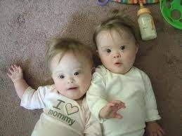 Identical Twins With Down Syndrome Beautiful Children Beautiful Babies Precious Children