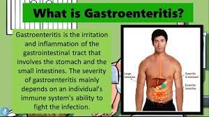 Gastroenteritis, also known as infectious diarrhea and gastro, is inflammation of the gastrointestinal tract—the stomach and intestine. Viral Gastroenteritis Jcf Medical Services Branch