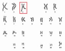 Two copies of chromosome 14, one copy inherited from each parent, form one of the pairs. Chromosome 3 Wikipedia