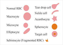 Red Blood Cell Rbc Morphology Peripheral Blood Smear