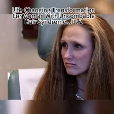 Hair Transformation Uncombable Hair Syndome Part 2 Result