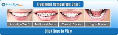 invisalign etobicoke etobicoke on invisalign braces