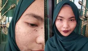 4 petua putihkan muka | ramai yang beranggapan bahawa kulit yang cerah itu cantik.mungkin benar telahan itu,mungkin juga petua mencerahkan kulit 1. Produk Putih Kulit Yang Paling Popular Dan Berkesan Baca Ni Iluminasi