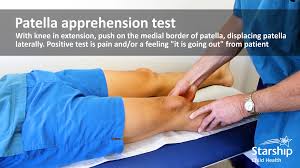 Image result for Patellar Apprehension Test