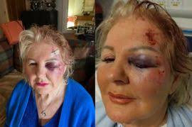 Scots mum whose son died while ice skating fights for public access to  defibrillators