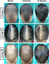 Hair gel holds in the right amount of moisture to make the hair softer and easier to manage. 2