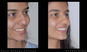 Pure Dental Clinic in Adajan Road,Surat