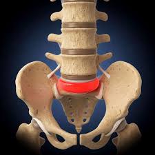 Image result for vyhřezlá ploténka