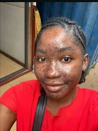 Chichewa Chipani Discussion