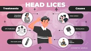 Image result for lice vs dandruff