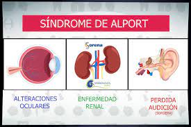 Maybe you would like to learn more about one of these? Nefrologia Peru Que Es El Sindrome De Alport Facebook