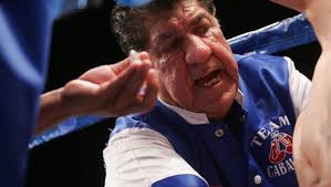 Boxer Randy Caballero through the years