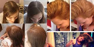 Lavare i capelli con solo acqua: 2 Blogger Non Lavano I Capelli Per 20 Giorni Ecco Cosa E Successo