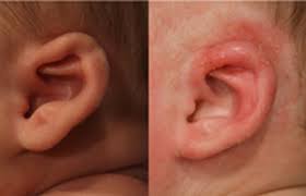 نتیجه جستجوی لغت [constricted] در گوگل