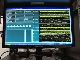 Monitorul de vrancea este cotidianul care, începând cu anul 2002, reprezintă principala sursă de informație pentru vrânceni și pentru toți. Cutremur De 3 9 Grade Pe Scara Richter Azi La Ora 13 20 In Vrancea