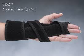 Image result for Radial Gutter Cast