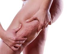 Doing it on a regular basis can actually make a major impact on blasting away cellulite on your thighs. What Causes Cellulite And How You Can Reverse It Sd Body Contouring