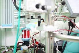 The ventilator that has been breathing. Ecmo Archives Esicm