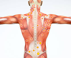 Upper border of ribs ii to v. Spine Muscles In Pain Myofascial Pain Syndrome May Be To Blame