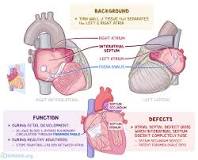 Image result