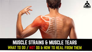 The best way to tell the difference between a pulled muscle or lung pain is to visit your primary care provider. Muscle Strains Muscle Tears What To Do Not Do How To Heal From Them Youtube