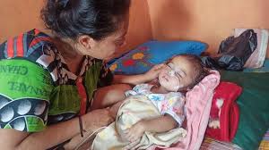 We did not find results for: Kisah Pilu Bocah Aurora Alami Radang Otak Dan Hidup Tanpa Sum Sum Tulang Belakang Tribun Medan