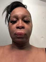 Mum says she was 'left looking like camel' after toddler launches phone at  her