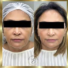 Dra. Erika Arrais Peter