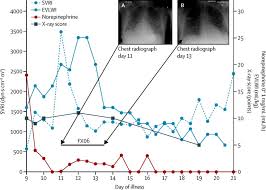 However, measures can be taken to improve a patient's chances of survival. Severe Ebola Virus Disease With Vascular Leakage And Multiorgan Failure Treatment Of A Patient In Intensive Care The Lancet