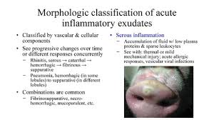 This section is from the book a manual of pathological this is the common inflammation of mucous membrane; Lecture 15 Patterns Of Inflammation Flashcards Quizlet