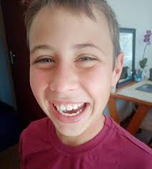 Stilbaaier se enigste kind (12) sterf ná diabetiese koma