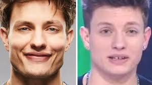 Comedian Matt Rife used to look very different | The Cairns Post