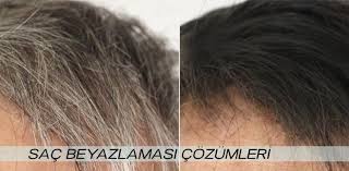 Örneğin birinin tavan boyası iyiyken diğerinin su bazlıları daha iyi olabilir. Sac Beyazlamasi Cozumleri