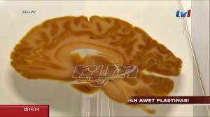 Laporan ini menjadi kelebihan pada anda kerana setiap butiran kewangan di. Modiezham Plastination Youtube