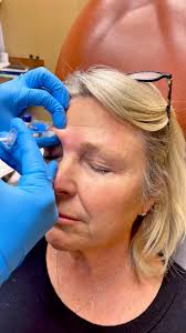 Did you know that basal cell and squamous cell carcinoma are the two most  common forms of skin cancer? ☀️ While they're highly treatable when  caught...