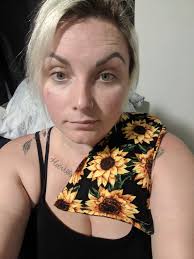 These has been the best bandages, they don't irritate my skin like the  others and they help bring them to a head 🙏🏾