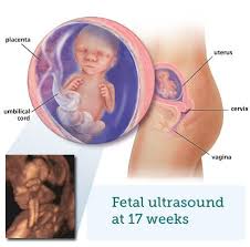 Fetal Ultrasound 4 Months Babycentre Uk
