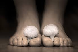 Preventing And Treating Athlete S Foot Podiatrist In Gainesville Va