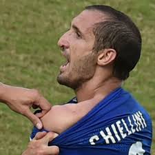 Chiellini: “Suárez me ha mordido, debería haber sido expulsado”
