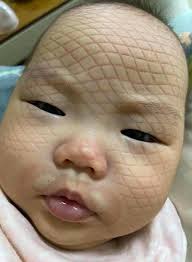 Link Exchange community