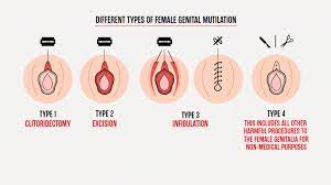 Female Circumcision In Malaysia Explained Postpartum Care Kit Circumcision Biology Worksheet